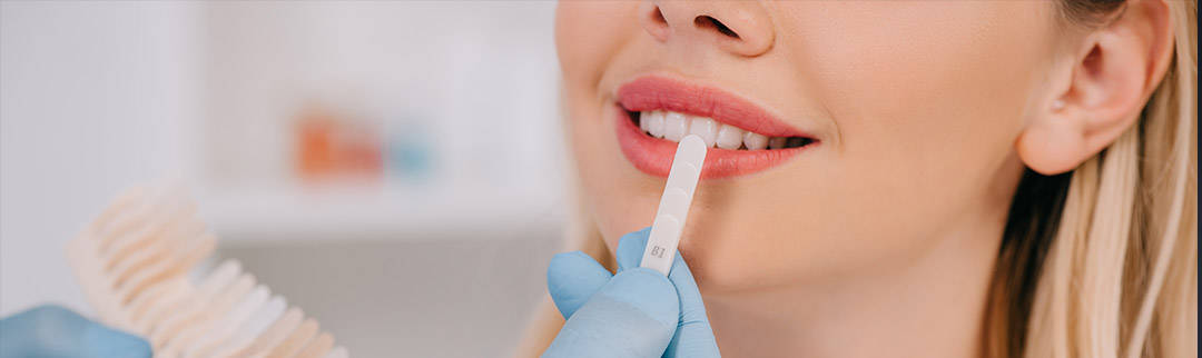 teeth whitening treatment