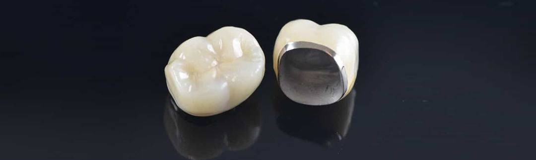 dental crown care