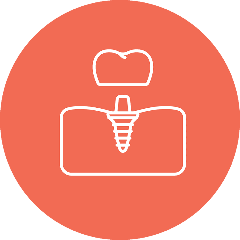 dental-implants dental implants