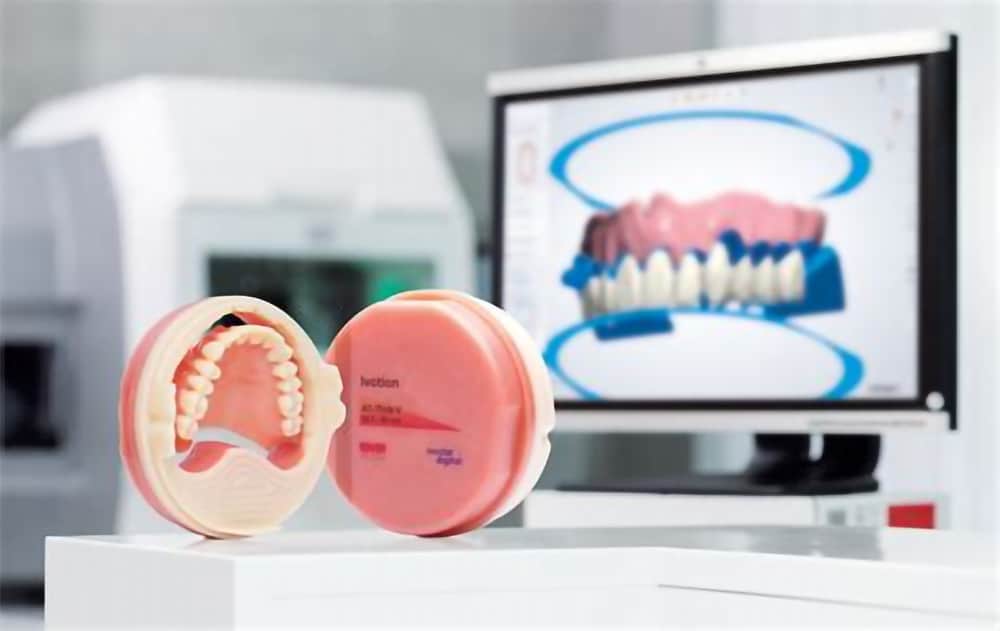 digital denture