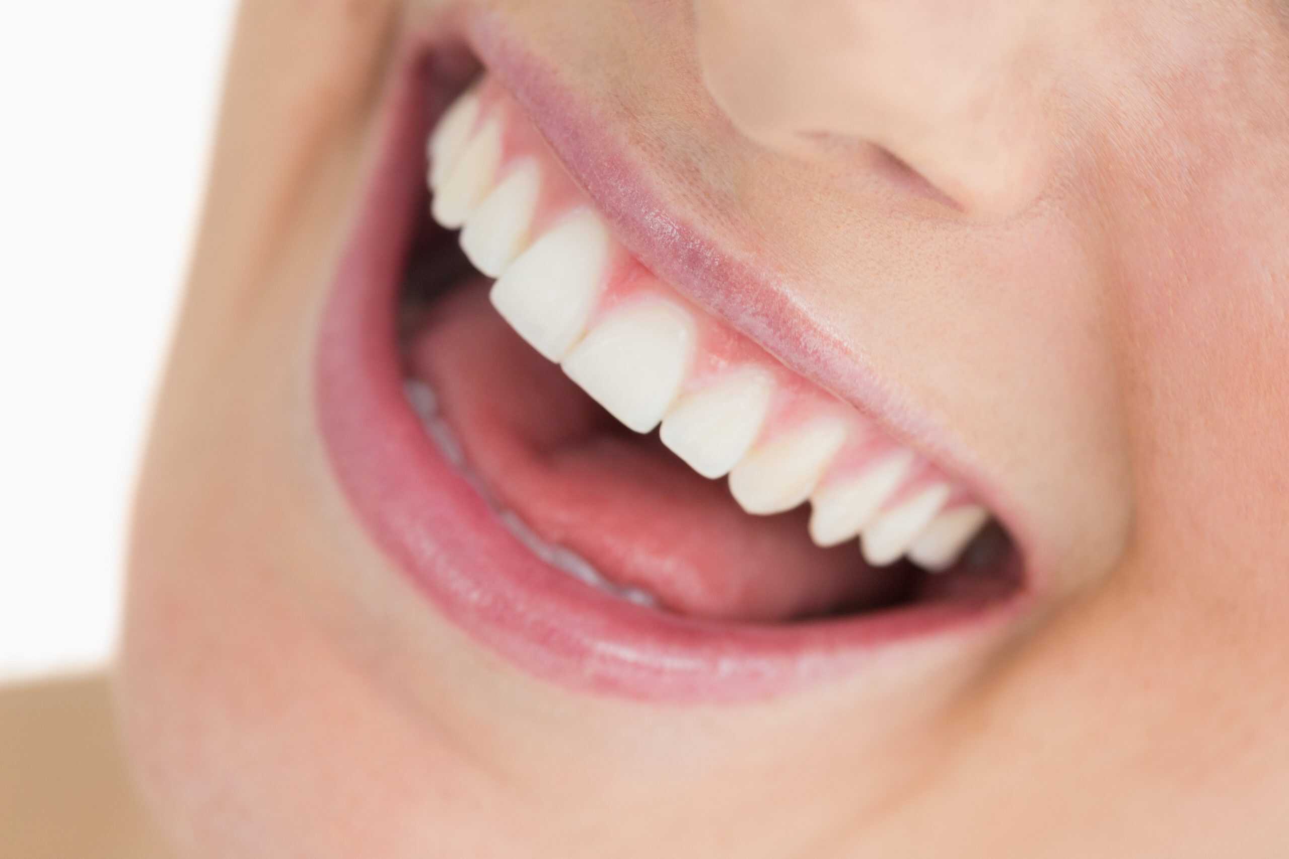 Transform Your Smile with Tooth Reshaping and Contouring