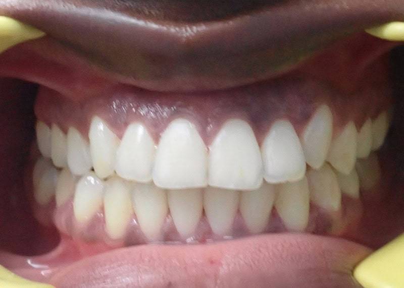 after victor dentist etobicoke