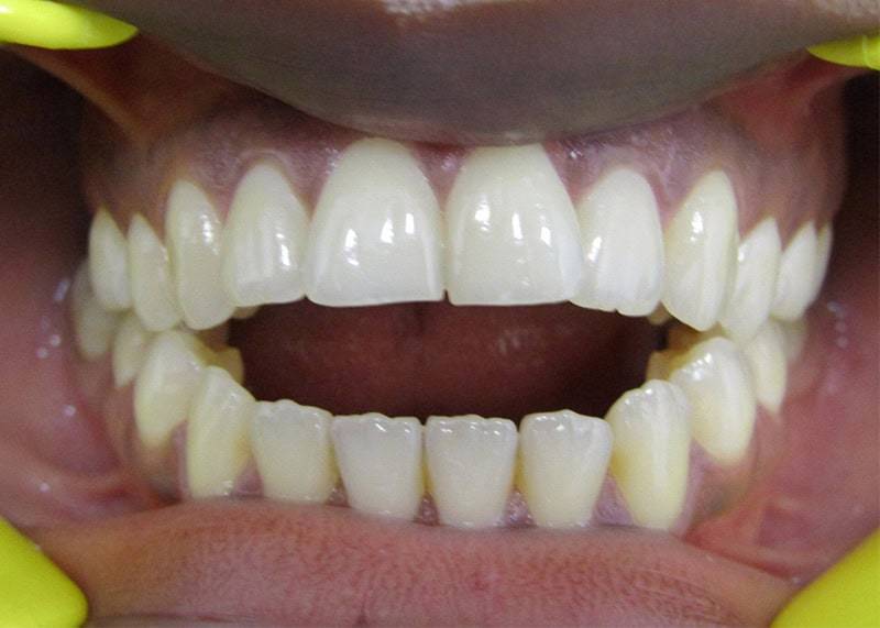 before victor dentist etobicoke