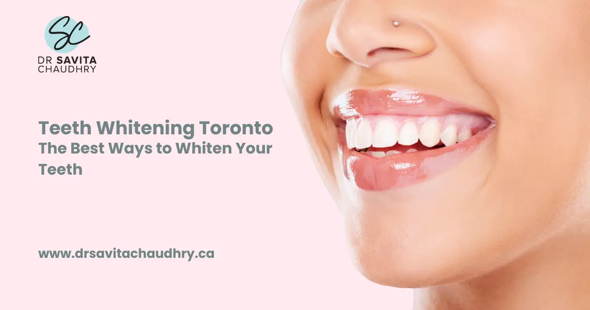 Teeth Whitening Toronto The Best Ways to Whiten Your Teeth