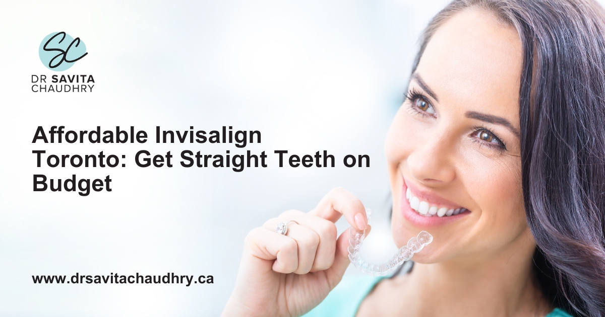 Affordable Invisalign Toronto Get Straight Teeth on Budget