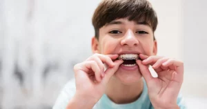 Smile Simulation Service Smile Simulation Service