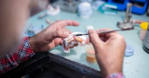 Find the Best Denture Repair Toronto Services Find the Best Denture Repair Toronto Services