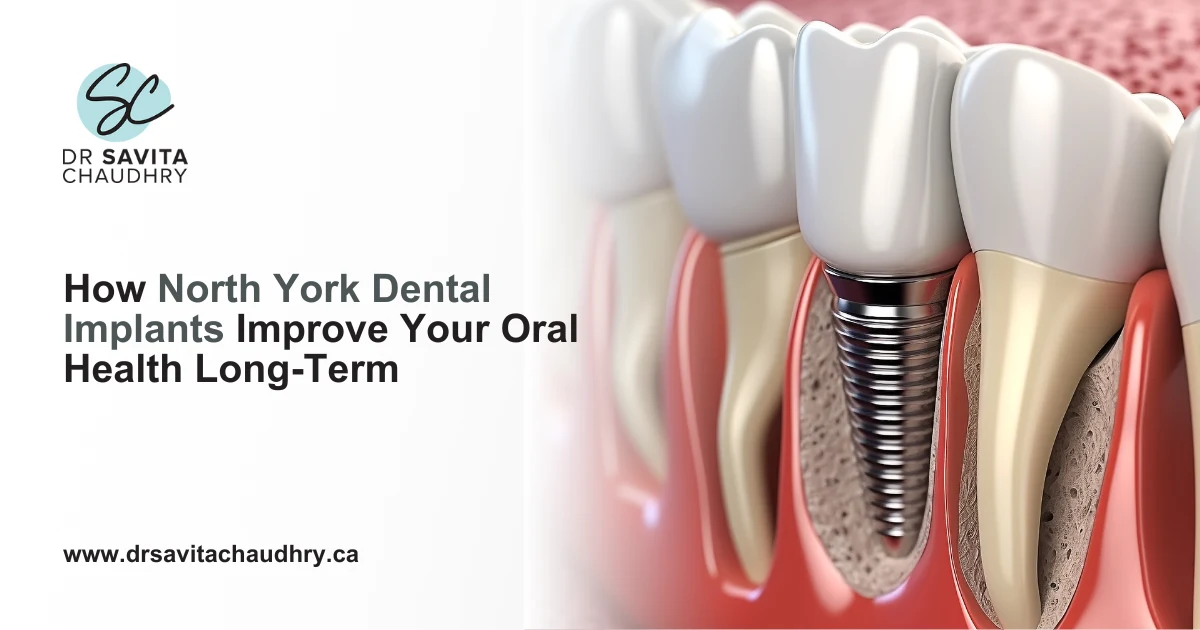 How North York Dental Implants Improve Your Oral Health Long Term
