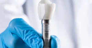 North York Dental Implants North York Dental Implants