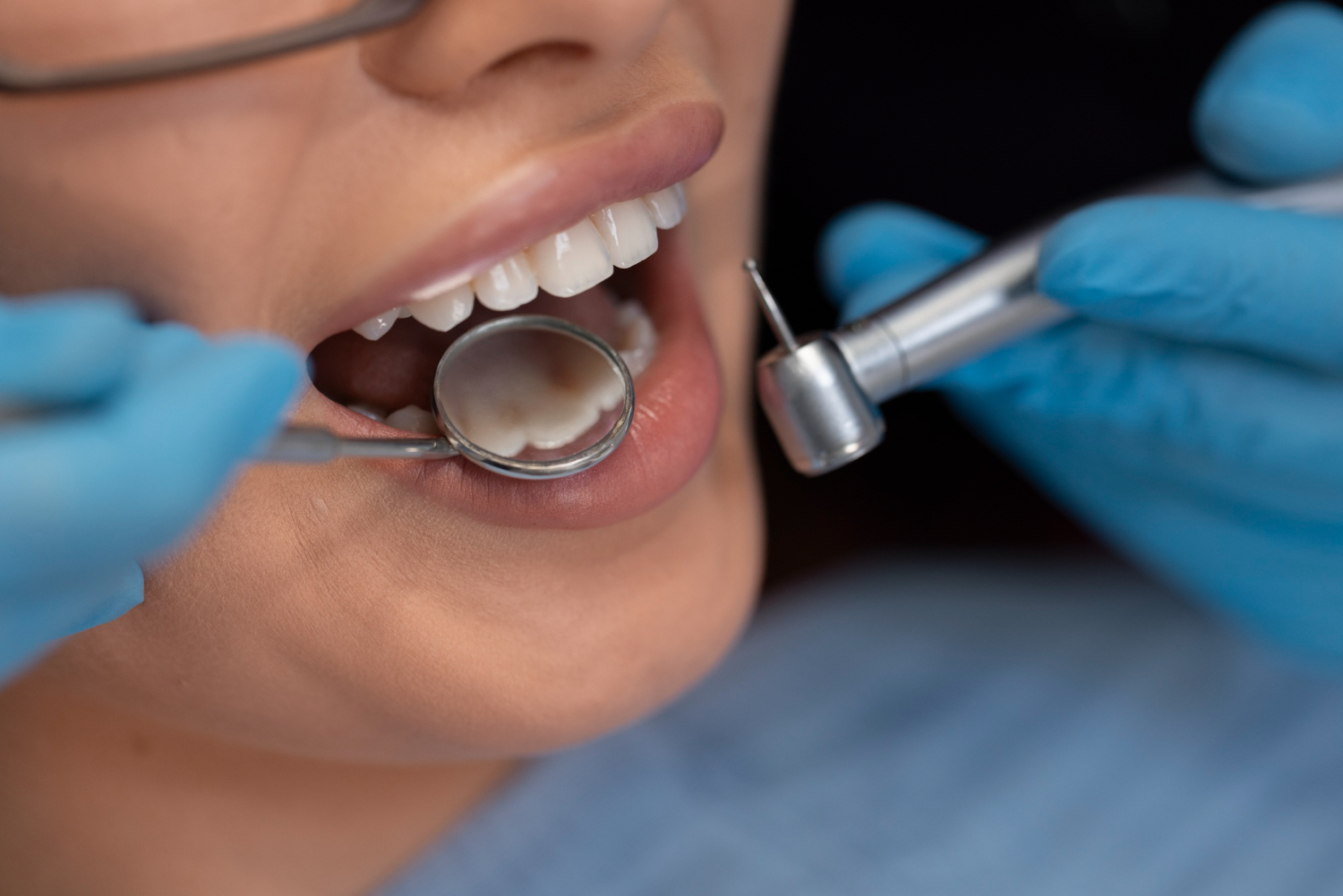 Dental Implants Process