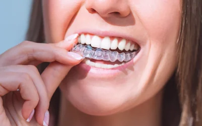 Invisalign®: The Clear Alternative to Braces