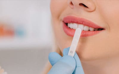 New Year, New Me! What You Should Know About Teeth Whitening