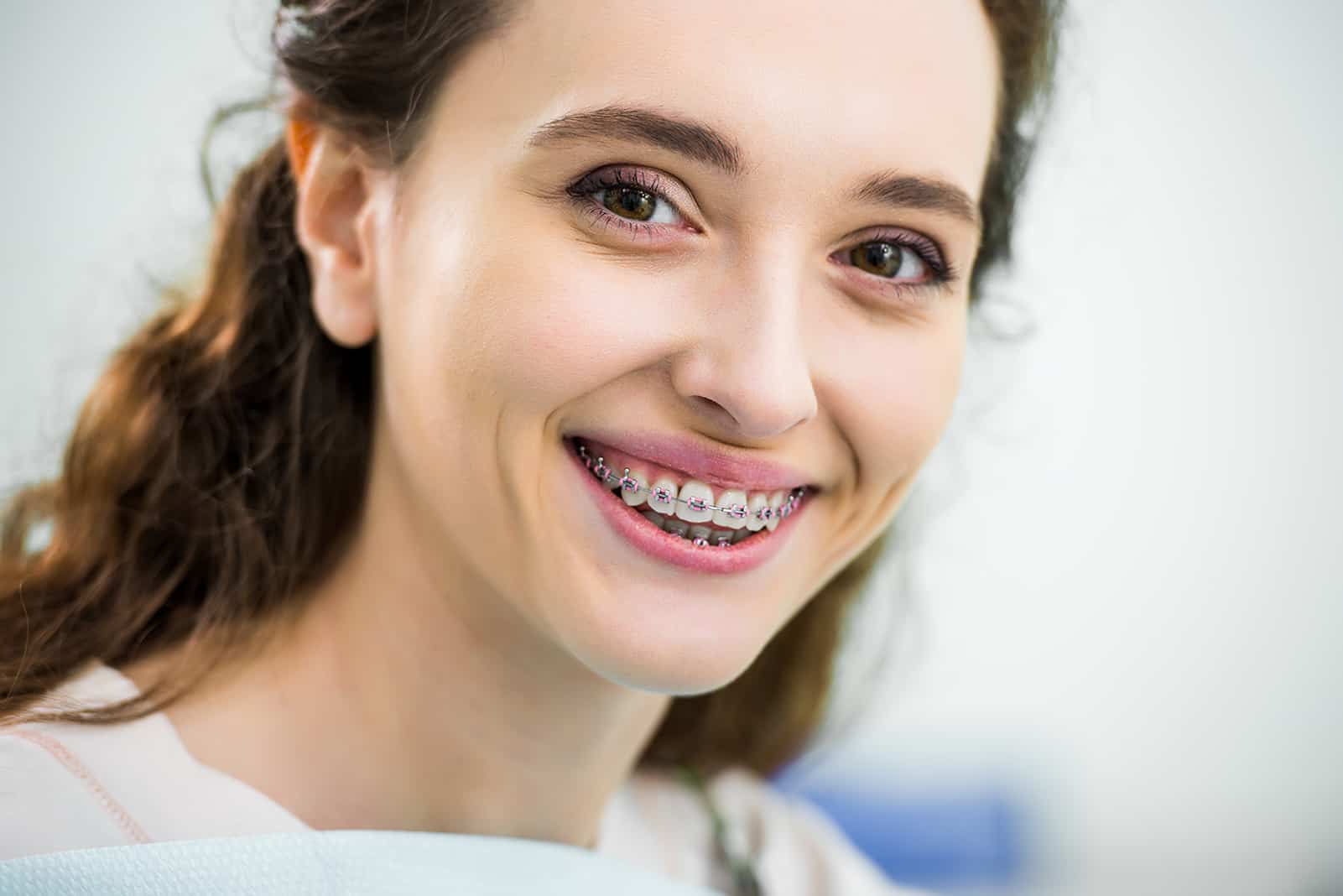 braces treatment for teeth alignment