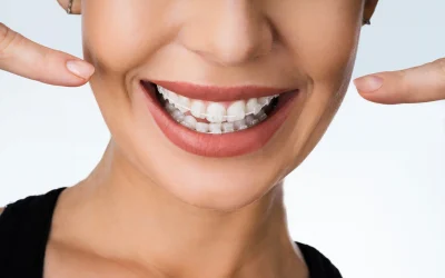 How to fix overbite teeth (Buck Teeth)
