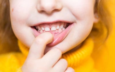 Understanding Malocclusion: Types, Causes, and Treatment Options