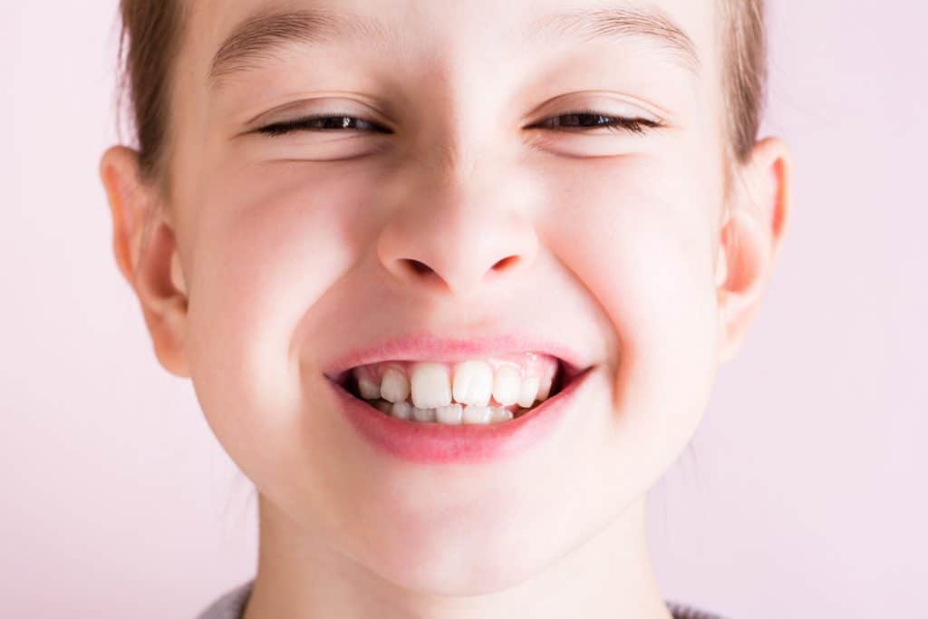Can Teeth Crowding Be Prevented? Causes, Symptoms, and Treatment