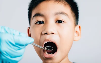 How to Deal with Cracked or Broken Teeth