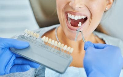 5 Types of Dental Crowns and their cost