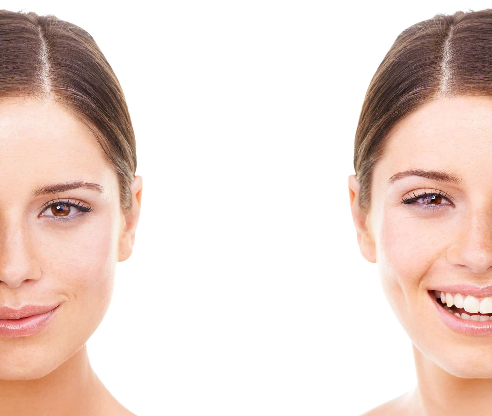 smile makeover boosts confidence