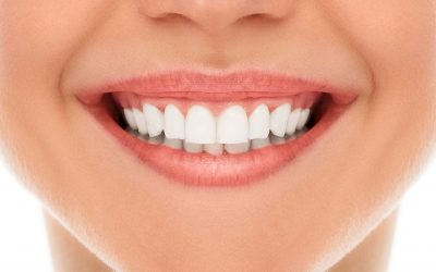 How Gum Contouring Can Boost Your Confidence and Improve Your Smile?