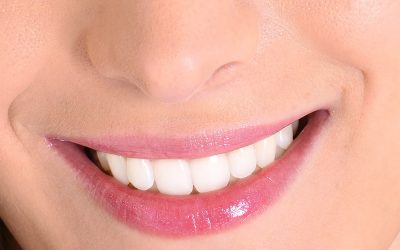 Complete Your Smile Makeover with a Dental Smile Lift