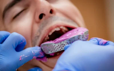 Orthodontic Options for Adults: Unlock Your Best Smile Today