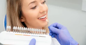 Types of Veneers