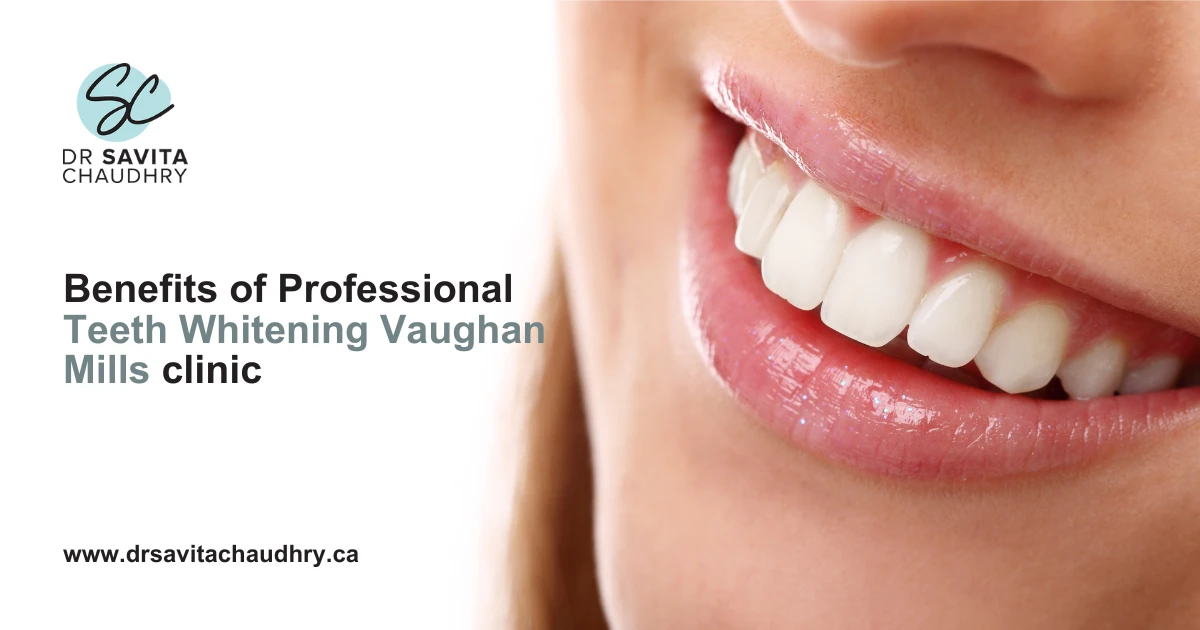 Benefits of Professional Teeth Whitening Vaughan Mills clinic Benefits of Professional Teeth Whitening Vaughan Mills clinic