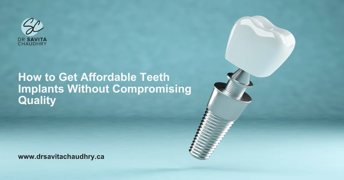 How to Get Affordable Teeth Implants Without Compromising Quality How to Get Affordable Teeth Implants Without Compromising Quality
