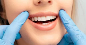 Professional Teeth Whitening Vaughan Mills