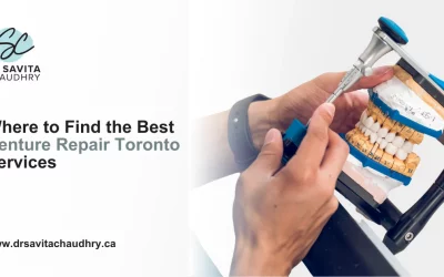 Where to Find the Best Denture Repair Toronto Services