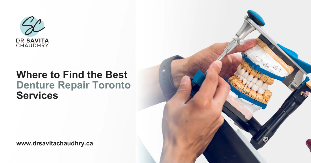 Where to Find the Best Denture Repair Toronto Services Where to Find the Best Denture Repair Toronto Services