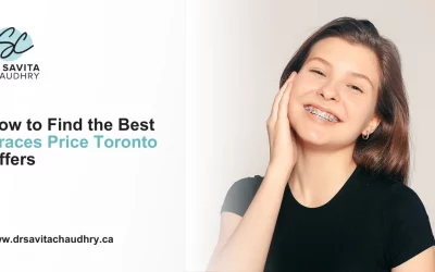 How to Find the Best Braces Price Toronto Offers