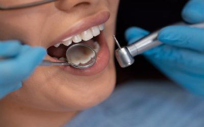 A Simple Guide to The Dental Implants Process