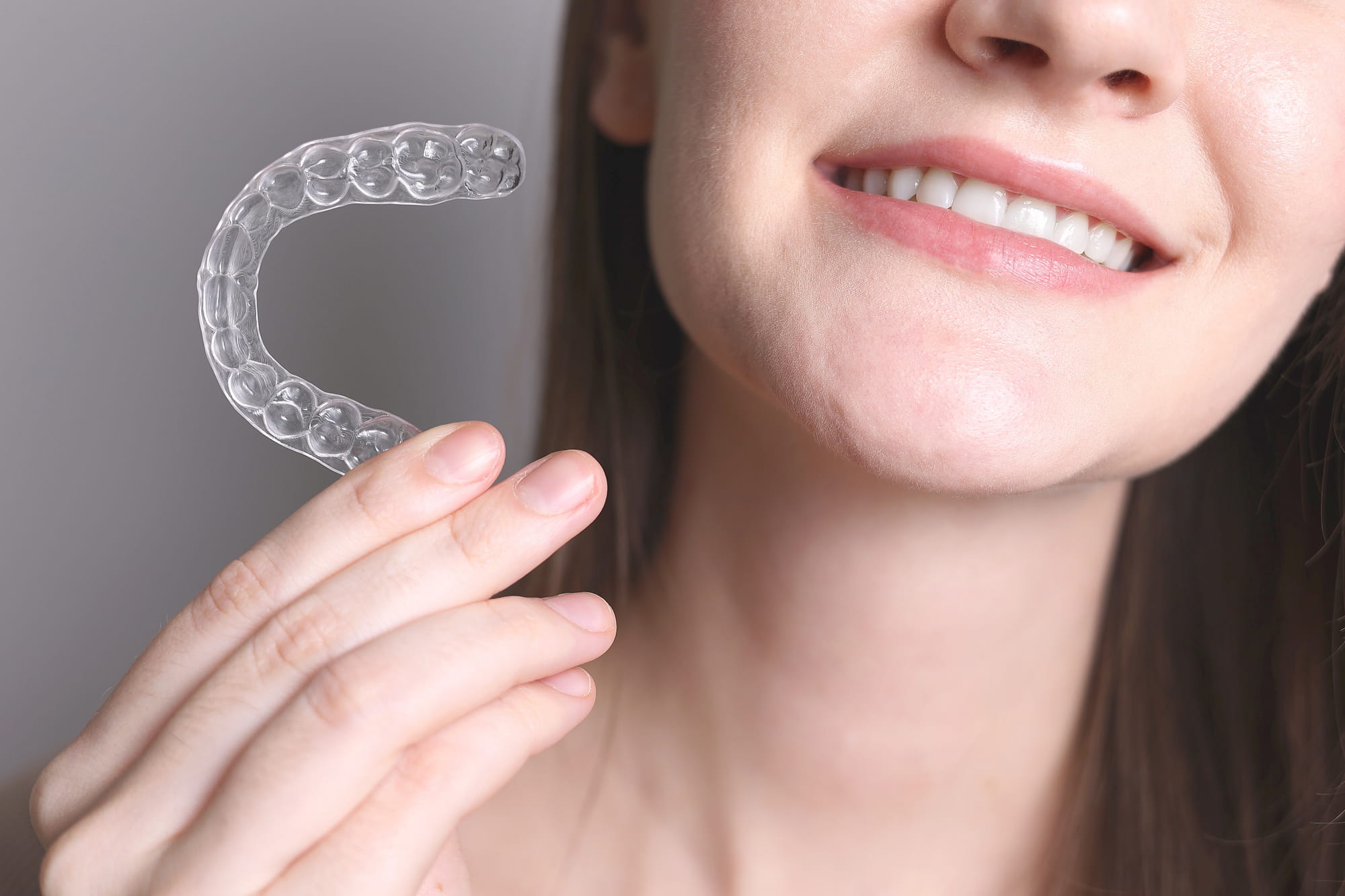 Invisalign Attachments How They Speed Up Teeth Straightening