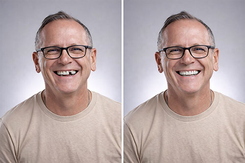 old age broken teeth fix