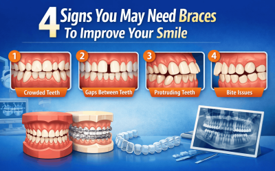 4 Signs You May Need Braces to Improve Your Smile